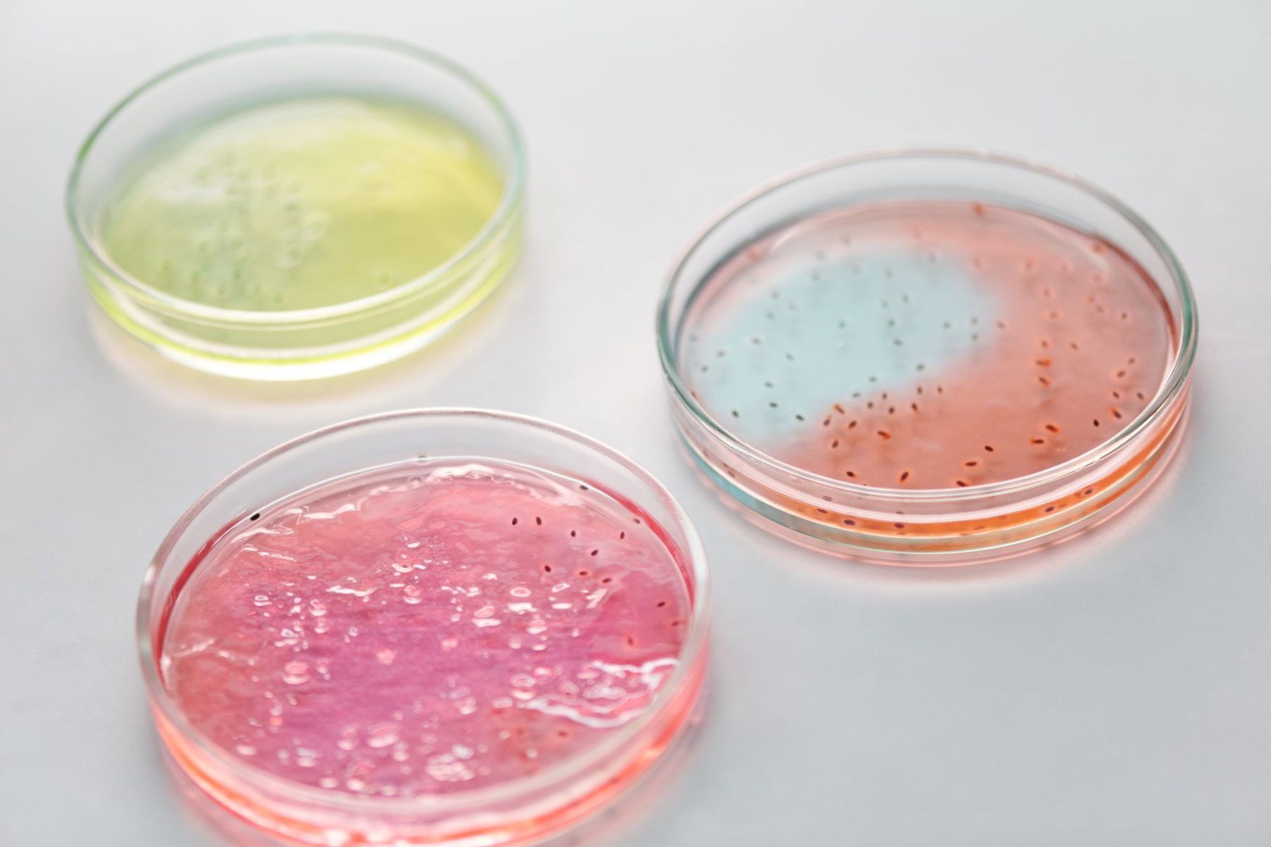 Tres placas de Petri con cultivos de microorganismos sobre una superficie blanca de laboratorio